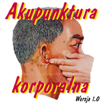 Akupunktura korporalna